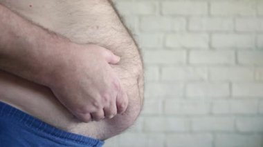 Şişko Adam Şişman Göbeğini Gösteriyor, Karnını Elleriyle Ölçen Aç Bir Kişi, Obeziteli Yaşlı Bir Adamın Sağlık Sorunları