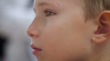 Sol gözünü - yavaş hareket üstünde küçük bir yara izi ile genç bir çocuğun yakın çekim