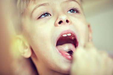 Çocuk hastanede tedavisi gören.