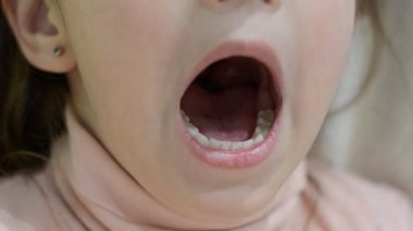Çocuk dişçisi cımbızla sallanıyor bebek dişleri sendeliyor ve düşecek.