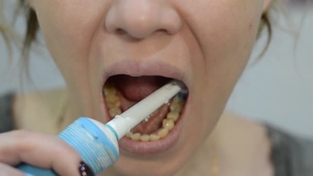 Mujer Cepilla Los Dientes Con Cepillo Dientes Eléctrico — Vídeo de stock