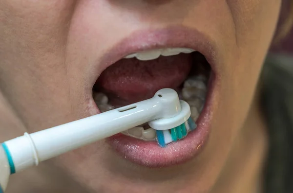 女は歯を電動歯ブラシで磨く — ストック写真
