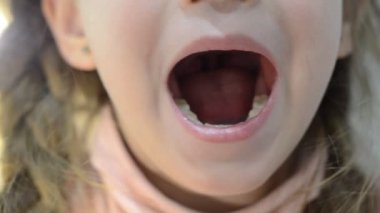 Çocuk dişçisi cımbızla sallanıyor bebek dişleri sendeliyor ve düşecek.