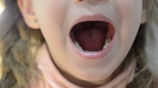Дитячий Стоматолог Пінцетом Розкручує Молочний Зуб Малюків Який Відштовхує Випаде — стокове відео