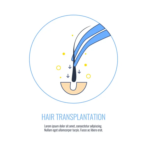Modèle de greffe de cheveux — Image vectorielle
