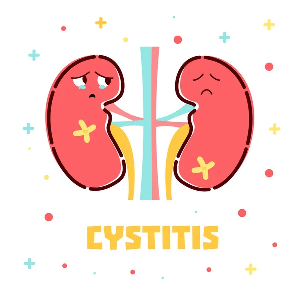 Cystitis kidneys poster — Stock Illustration Cystitis kidneys poster Vector Graphics