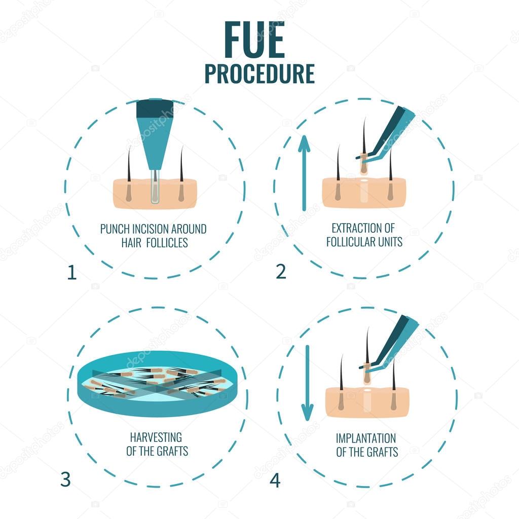 FUE stages treatment