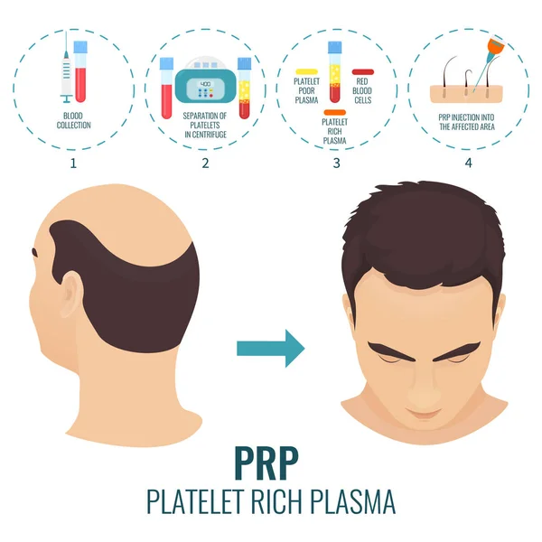 Cartaz de tratamento PRP —  Vetores de Stock