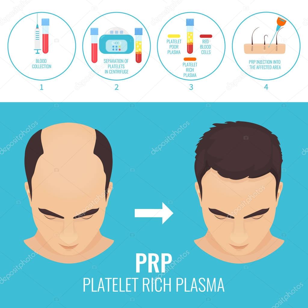Man before and after RPR therapy