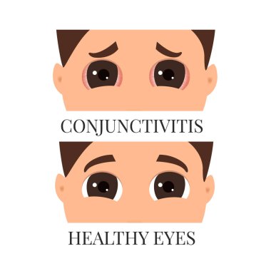 Man with conjunctivitis clipart