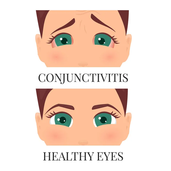 Vrouw met conjunctivitis — Stockvector