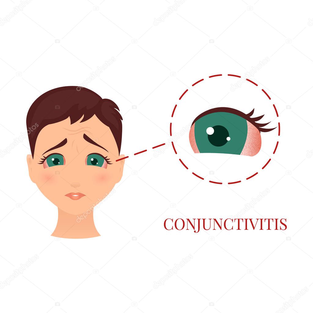 Woman with conjunctivitis
