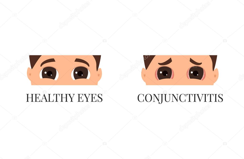 Man with conjunctivitis
