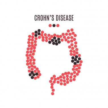 Crohns hastalığı hapları poster