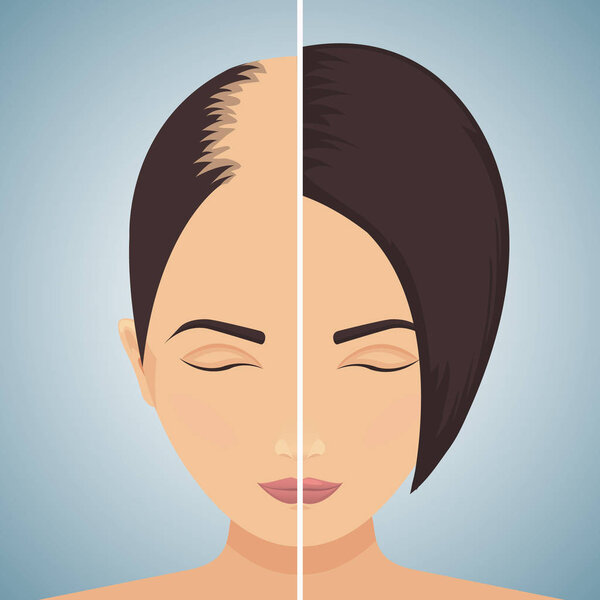 Hair loss in women-before after concept