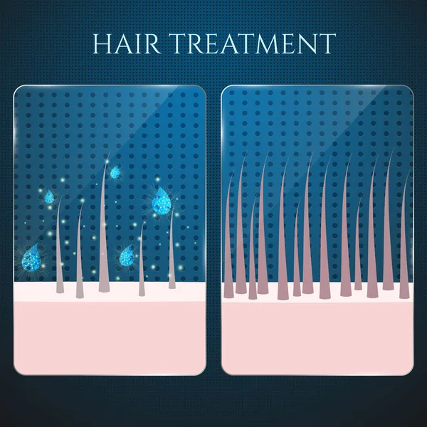 Hair follicles treatment closeup — Stock Vector