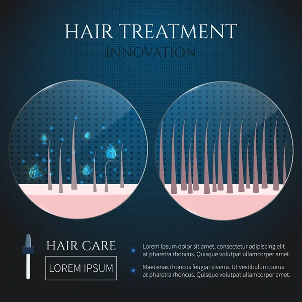 Folículos pilosos tratamiento primer plano — Vector de stock