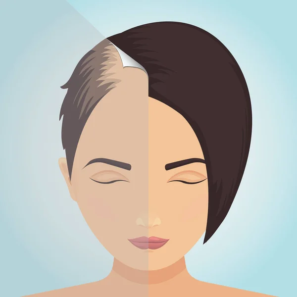 Perte de cheveux chez les femmes — Image vectorielle