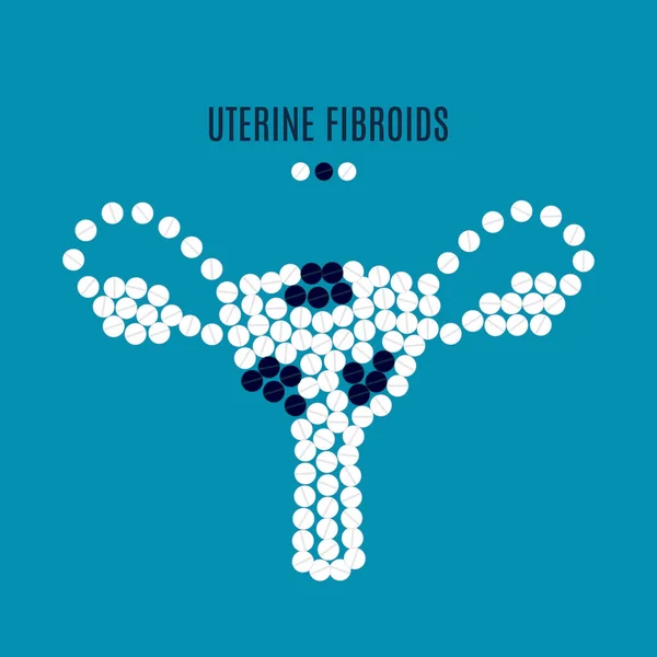 Píldoras de conciencia de fibromas uterinos cartel — Archivo Imágenes Vectoriales