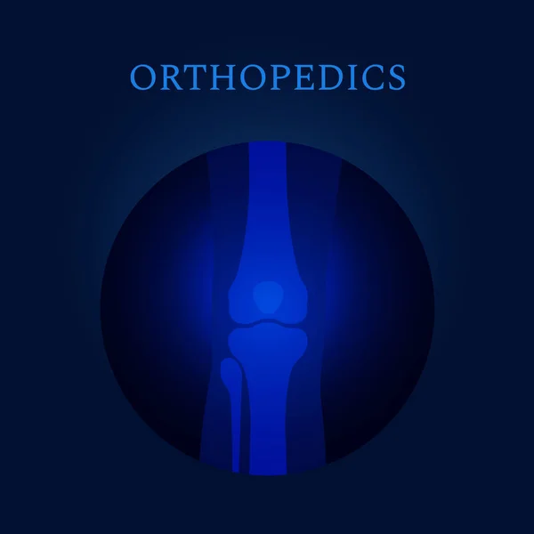 Lékařská šablona kolenního kloubu pro ortopedické kliniky — Stockový vektor