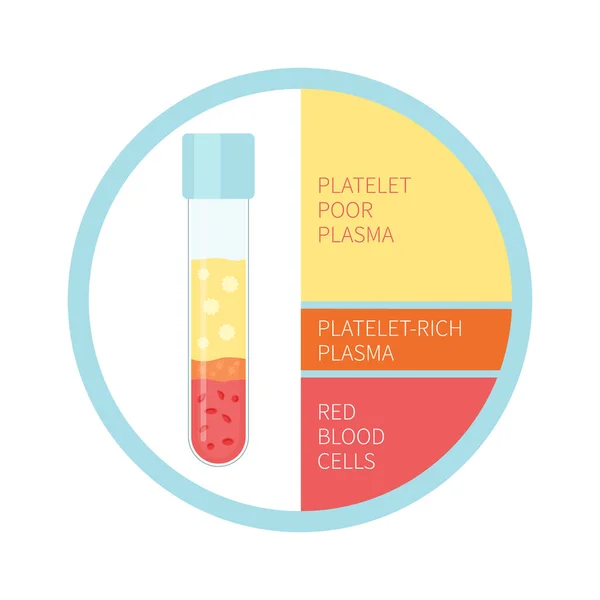 Platelet rich plasma blood composition medical infographics — 스톡 벡터