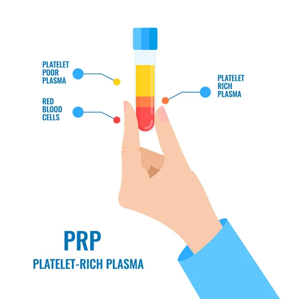 Plantilla de infografías de estructura sanguínea PRP con un tubo en la mano de los médicos — Vector de stock