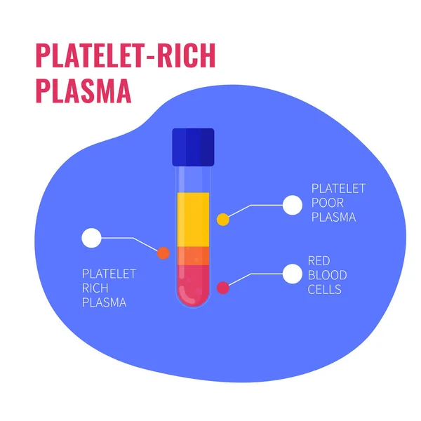 Инфографический медицинский постер богатого тромбоцитом плазменного состава — стоковый вектор