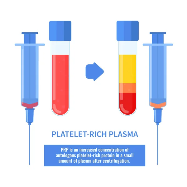 Plaquetas rico en plasma procedimiento de terapia infografías cartel — Vector de stock