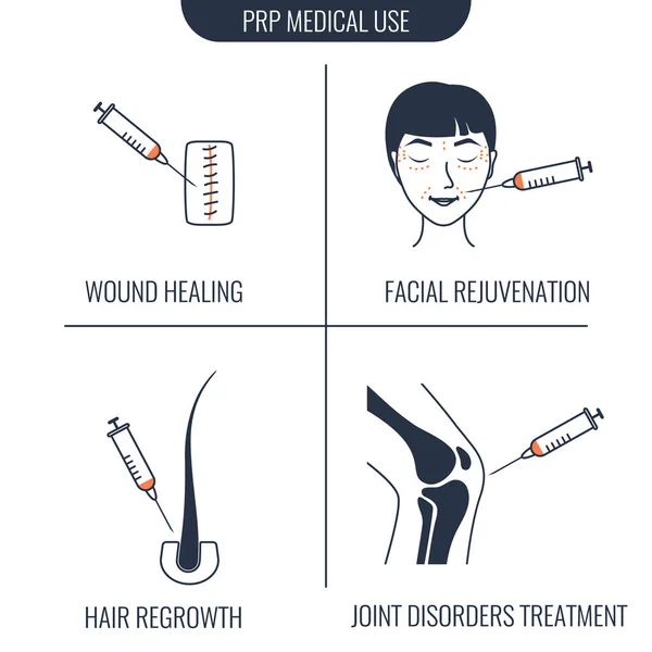 PRP lékařské použití infografický set plakát v lineárním stylu — Stockový vektor