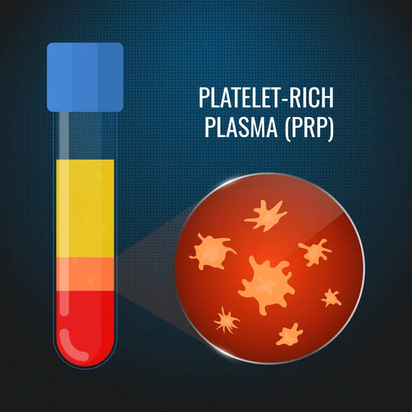 Primer plano de las plaquetas PRP en un tubo de ensayo — Vector de stock