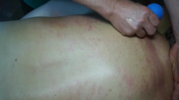 Las manos masculinas del médico hacen un masaje terapéutico en la espalda de la mujer por los bancos. Técnicas profesionales trabajan en los músculos de la espalda, relajándolos, rompiendo los puntos de disparo . — Vídeo de stock