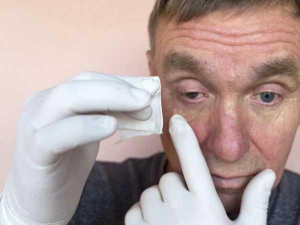 Inspeção Tratamento Olhos Masculinos Com Medicamentos Oftalmologia Doença Ocular Prevenção — Fotografia de Stock