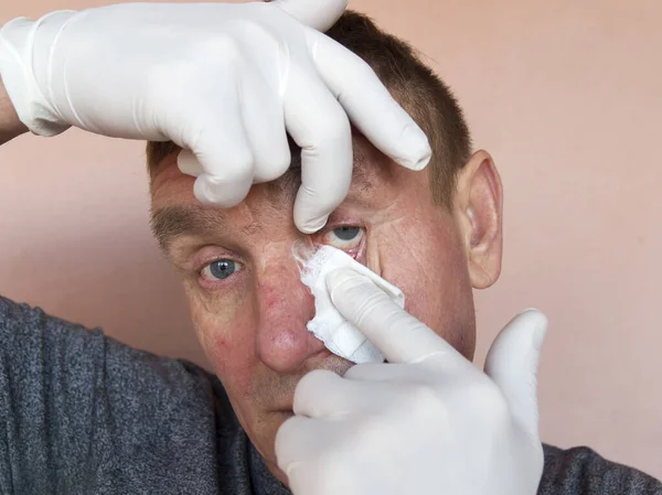 Inspeção Tratamento Olhos Masculinos Com Medicamentos Oftalmologia Doença Ocular Prevenção — Fotografia de Stock