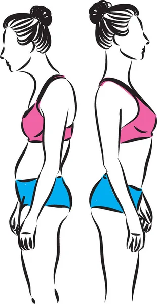 Γυναίκα εικονογράφηση διάνυσμα κακή στάση του σώματος — Διανυσματικό Αρχείο