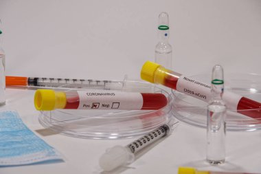 Coronavirus Covid-19 2019-ncov dünya salgın testleri mikrobiyoloji laboratuvarında.