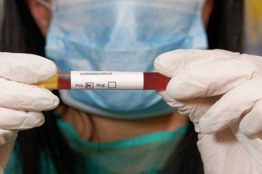 Coronavirus Covid-19 2019-ncov dünya salgın testleri mikrobiyoloji laboratuvarında.