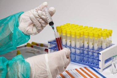Coronavirus Covid-19 2019-ncov dünya salgın testleri mikrobiyoloji laboratuvarında.
