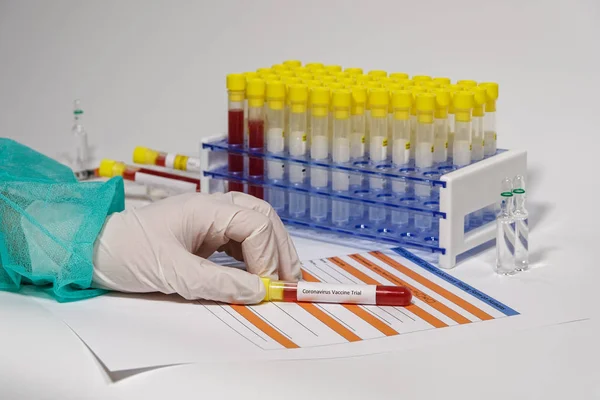 Coronavirus COVID-19 2019-nCoV world outbreak tests on microbiology lab.