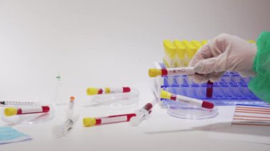 Coronavirus Covid-19 2019-ncov dünya salgın testleri mikrobiyoloji laboratuvarında. Koruyucu beyaz eldivenli kimyager, Wuhan virüsünde pozitif bulunan klinik test sıvısı örneğiyle boş kan tüpü gösteriyor..