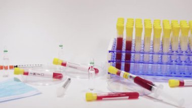 Coronavirus Covid-19 2019-ncov dünya salgın testleri mikrobiyoloji laboratuvarında. Tıbbi ekipmanlarla yapılan klinik testler şırıngalar ve Wuhan virüsü virüsünün boş kan tüpleri üzerindeki pozitif örnekleri de içeriyor..