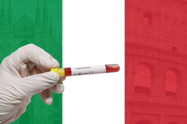 İtalya Coronavirus Covid-19 dünya salgını konsepti. Koruyucu eldivenli kimyager 2019-ncov virüsü içeren boş bir kan tüpünü Milan ve Roma resimli İtalyan bayrağından önce tutuyor..