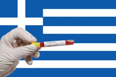 Yunanistan Coronavirus Covid-19 dünya salgını kavramı. Koruyucu eldivenli kimyager, Yunan bayrağından önce 2019 ncov virüsü içeren boş bir kan tüpü tutuyor..