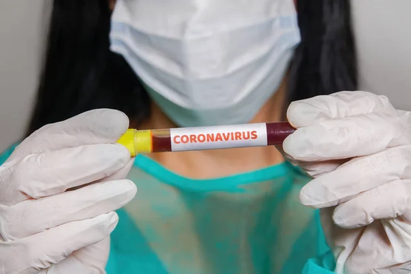 Covid Conceito Surto Mundial Com Etiqueta Coronavírus Vacutainer Química Feminina — Fotografia de Stock