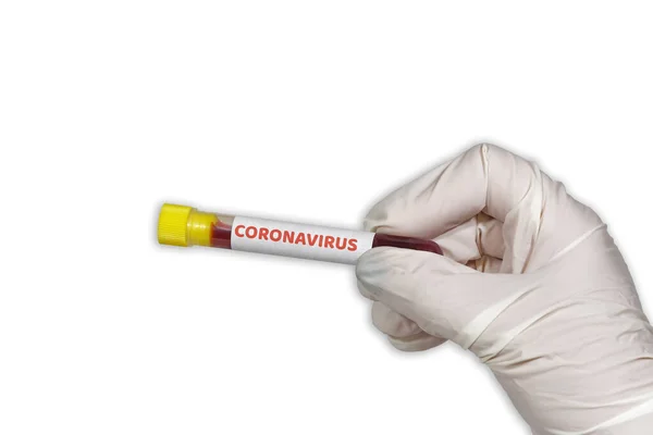 Covid Conceito Surto Mundial Com Etiqueta Coronavírus Vacutainer Química Feminina — Fotografia de Stock