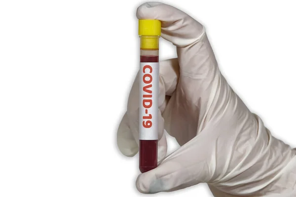 Coronavirus Wereld Uitbraak Concept Met Covid Tag Vacutainer Vrouwelijke Chemicus — Stockfoto