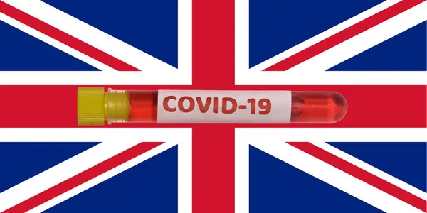 Spojené Království Coronavirus Covid Světová Epidemie Koncepce Krevní Sonda Vacutainer — Stock fotografie