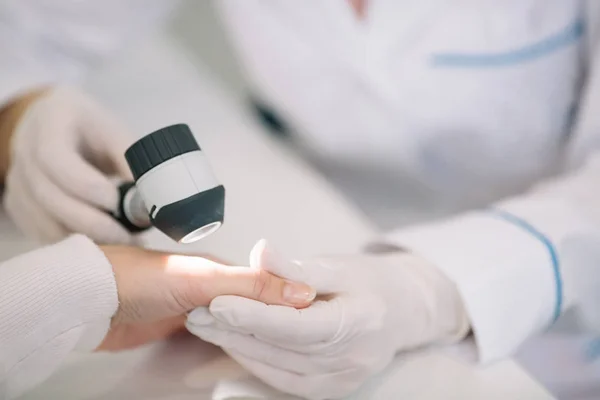 Köstebek kadın patien yandan inceleyerek dermatolog closeup