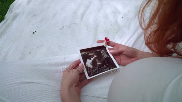 Echografie afbeelding in vrouw handen op de achtergrond van witte stof — Stockvideo