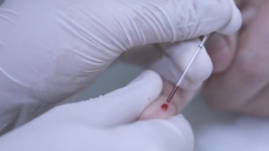 Kan örneği toplama. HIV testi kan toplama. Parmak kan testi