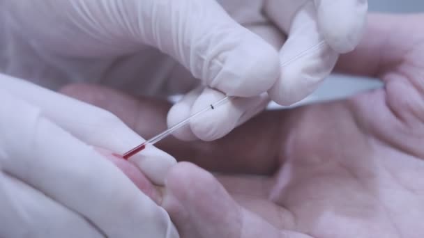 의사가 손을 의료 테스트에 대 한 혈액 샘플을 복용. 손가락 혈액 검사 — 비디오